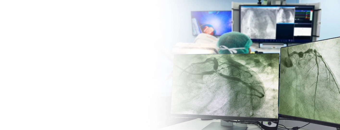 Difference Between Angiography and Angioplasty: A Detailed Guide